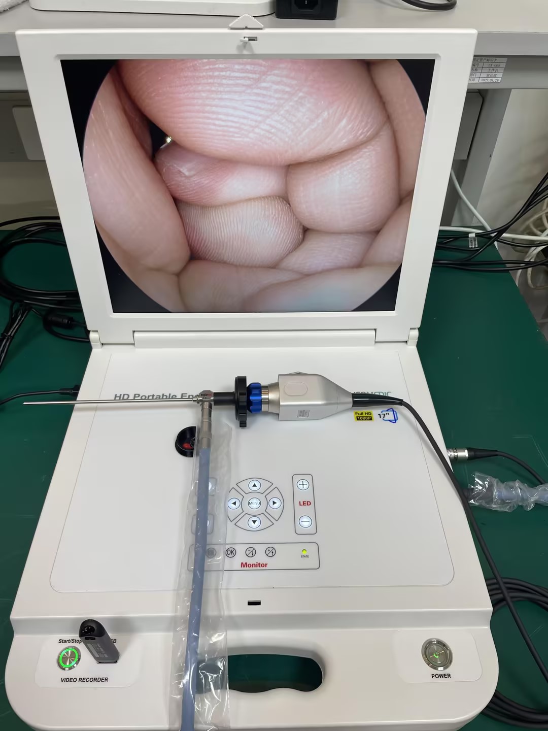 All in 1 HD Portable Endoscopy Unit